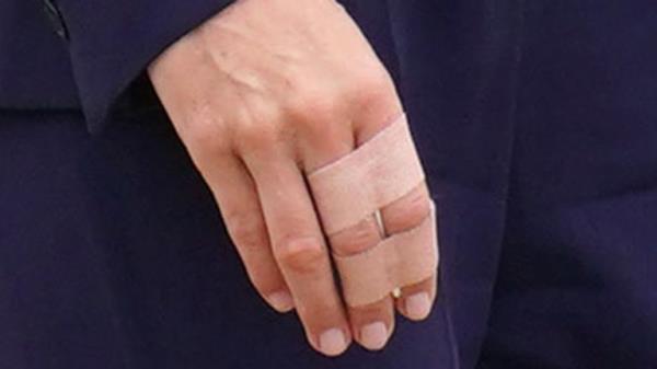 The Princess of Wales with bandages wrapped around her fingers during a visit to HMP High Down in Surrey, to learn a<em></em>bout how the Forward Trust charity is supporting those in the criminal justice system to manage and recover from their addictions. Picture date: Tuesday September 12, 2023.