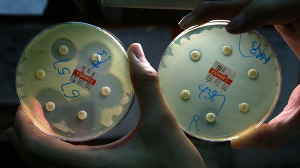 超级细菌的数量正在上升我们怎样才能防止抗生素过时呢?