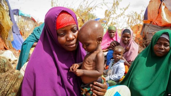 FILE - A woman from the drought-stricken Lower Shabelle region holds her 1-year old malnourished child at a makeshift camp for the displaced on the outskirts of Mogadishu, Somalia, June 30, 2022.