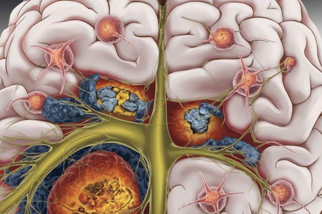 30-facts-a<em></em>bout-experimental-allergic-encephalomyelitis