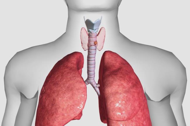 30-facts-a<em></em>bout-nonmedullary-thyroid-carcinoma