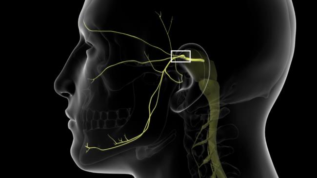 50-facts-a<em></em>bout-trigeminal-neuralgia