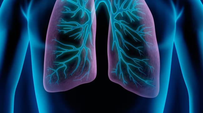 30-facts-a<em></em>bout-eosinophilic-pneumonia-ep